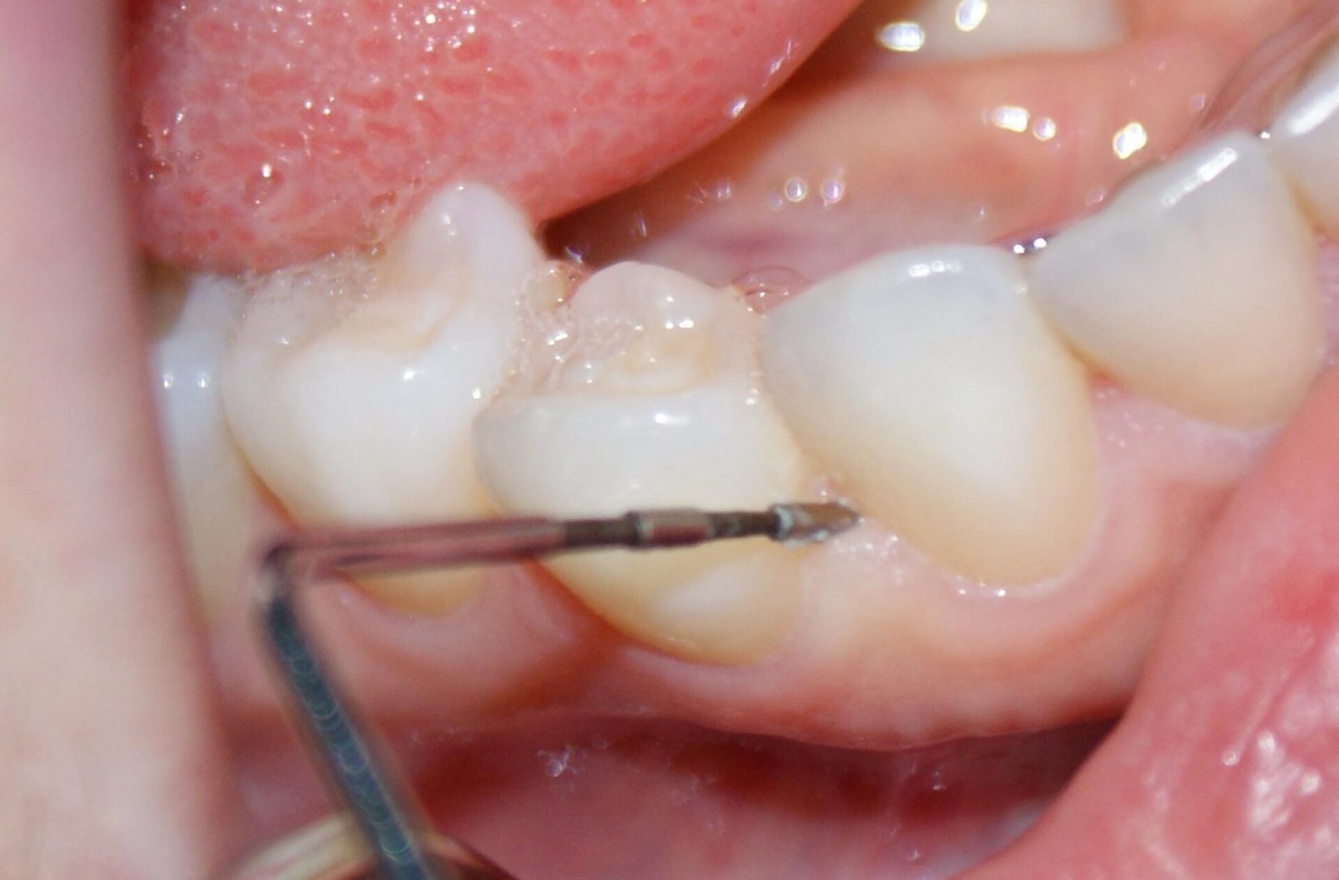 Periodontologia i mikrochirurgia